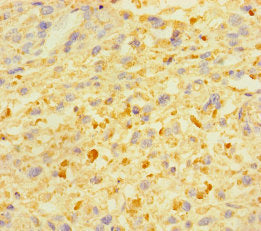 ZSCAN29 Antibody