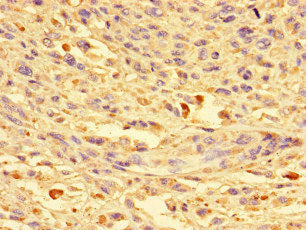 CKAP2L Antibody
