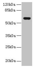 KATNAL2 Antibody