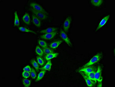 CMTM8 Antibody