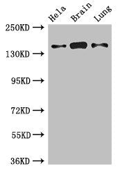 SULF2 Antibody