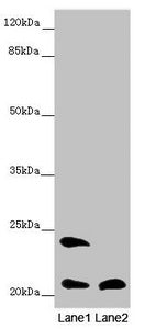 MSRB3 Antibody