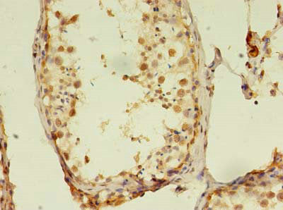 RTKN2 Antibody