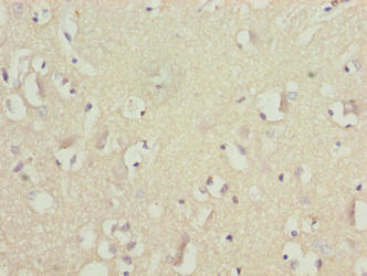 GLB1L2 Antibody