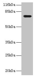 KBTBD2 Antibody