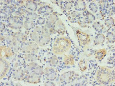 RFX6 Antibody