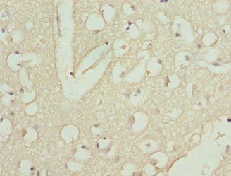 CAMK1D Antibody