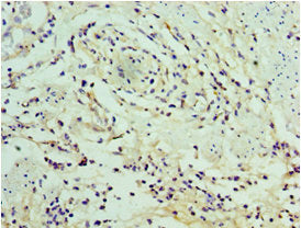 SERPINA12 Antibody