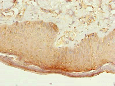 CMTR2 Antibody