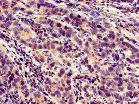 LOXHD1 Antibody