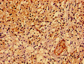 ASPM Antibody