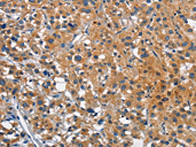 CEACAM1 Antibody