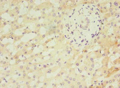 ANKMY2 Antibody