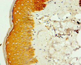 SMYD4 Antibody