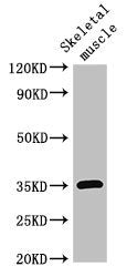 ELMOD2 Antibody