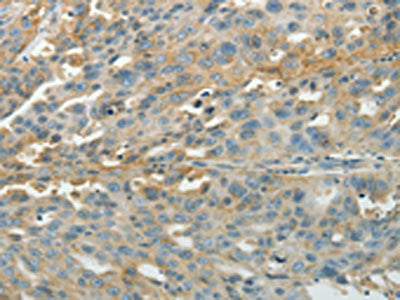 PXN Antibody