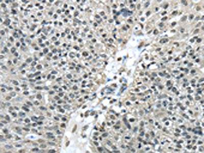FUS Antibody