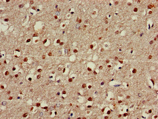 FOXRED2 Antibody