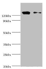 CCAR1 Antibody