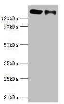 CCAR1 Antibody