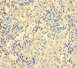 CCDC36 Antibody
