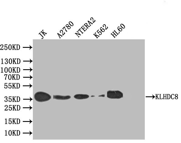 KLHDC8A Antibody