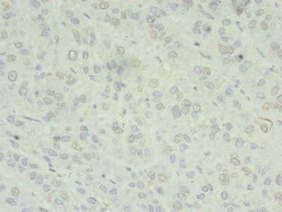 ZC3H7A Antibody