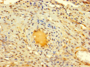 DIS3L2 Antibody