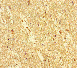 DOCK3 Antibody