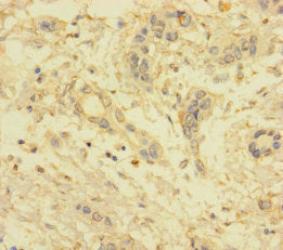 VKORC1L1 Antibody