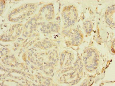 TAGAP Antibody