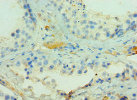 ADAMTSL1 Antibody