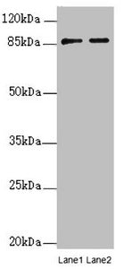 SUPT20H Antibody