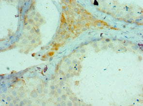 CTCFL Antibody