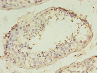 SPANXD Antibody
