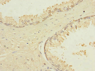 TRPM4 Antibody