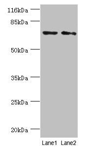 MAGEC3 Antibody
