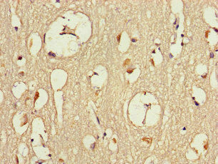 DMXL2 Antibody