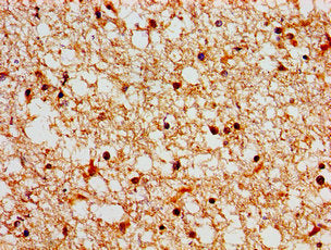 SH3TC2 Antibody
