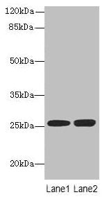 EEF1AKMT1 Antibody