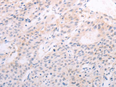 TSHR Antibody