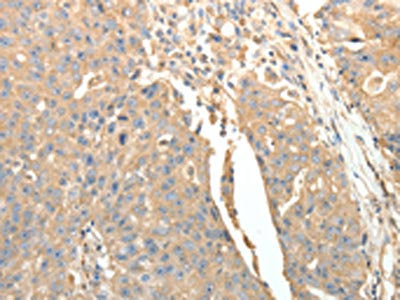 SFTPD Antibody