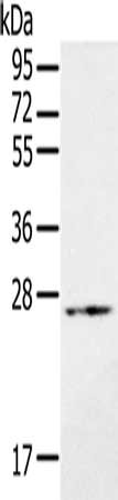 RAB21 Antibody