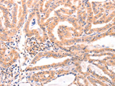 DAZ4 Antibody