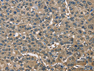 ENO1 Antibody