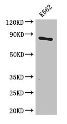 CPT1B Antibody