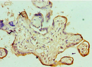 SMARCC1 Antibody