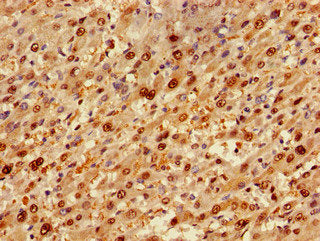 TP53INP1 Antibody
