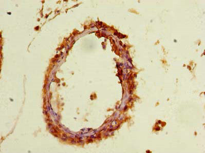 PYCR2 Antibody