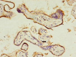 CTHRC1 Antibody